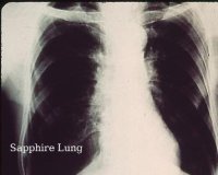 Cкриншот Sapphire Lung, изображение № 1955934 - RAWG