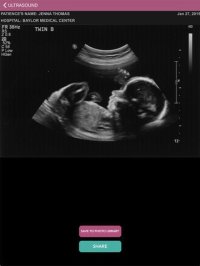 Cкриншот Ultrasound Spoof 2016: Pregnancy Test, изображение № 1757075 - RAWG
