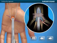 Cкриншот Virtual Carpal Tunnel Surgery, изображение № 953365 - RAWG