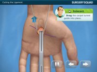 Cкриншот Virtual Carpal Tunnel Surgery, изображение № 953368 - RAWG